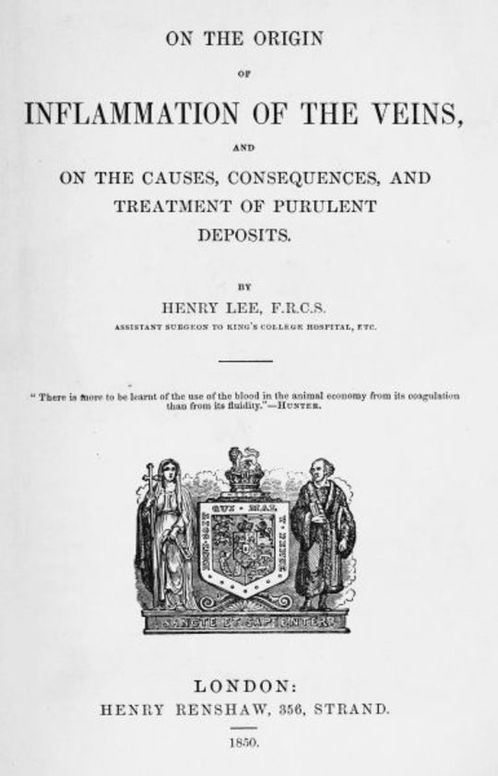 On the origin of inflammation of the veins and of the causes, consequences, and treatment of purulent deposits